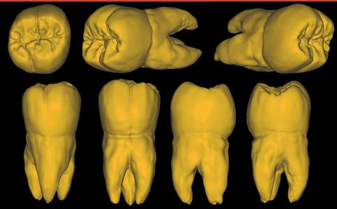 Maxillary Molar Sculpt with Roots Free STL
