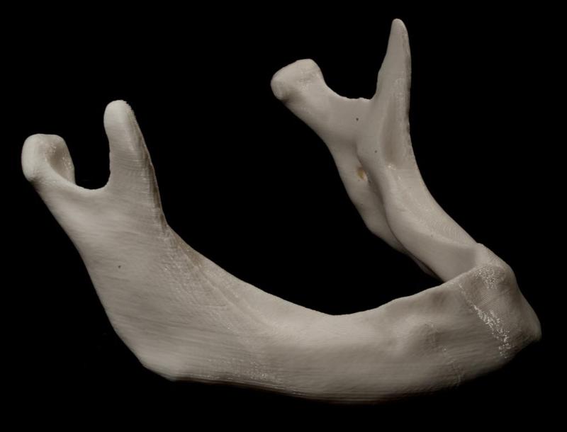 Human Mandible (Edentulous)