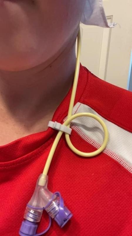 NG Tube Clip