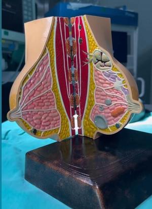 Breast healthy and diseased anatomy model