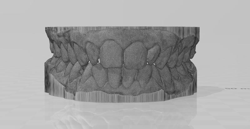 Full size Lower and upper teeth, occlusion