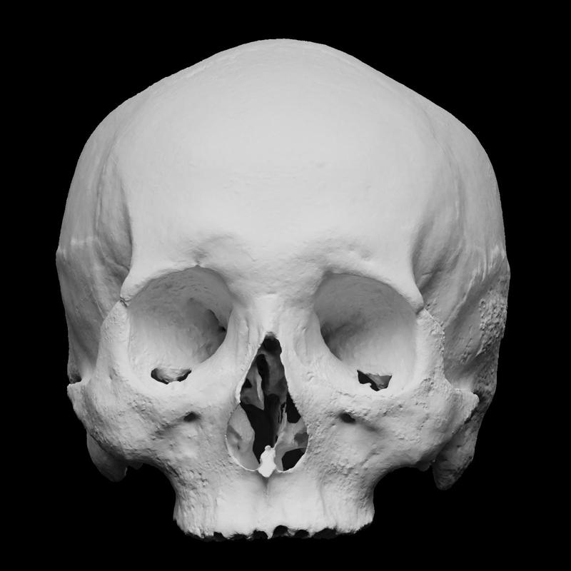 Human skull