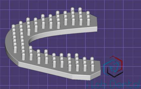 Exocad pin baseplate