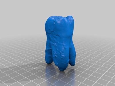 Molar Tooth First Upper FDI 16