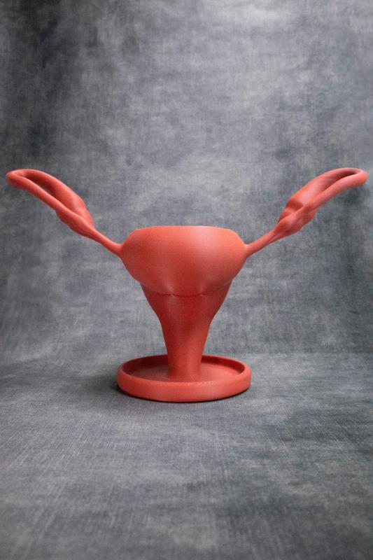 Uterus Pot (Pre Supported)