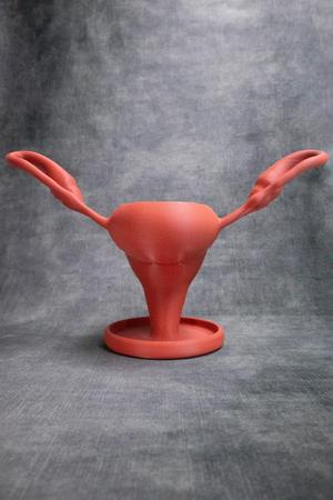 Uterus Pot (Pre Supported)