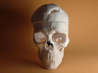 Stand for Skull of Phineas Gage