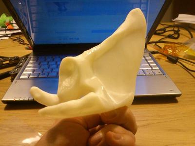 Scapula (Anatomical bone)