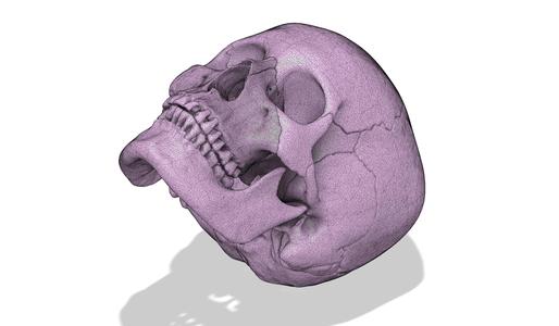 Human skull (exploded)