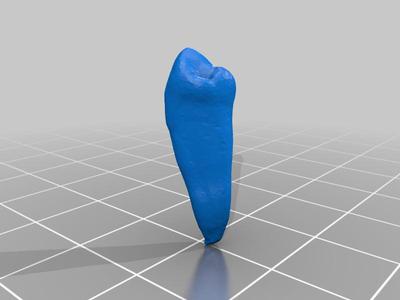 Tooth lower first premolar FDI 34