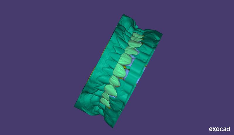 interior upper arch humen mouth my best desgin