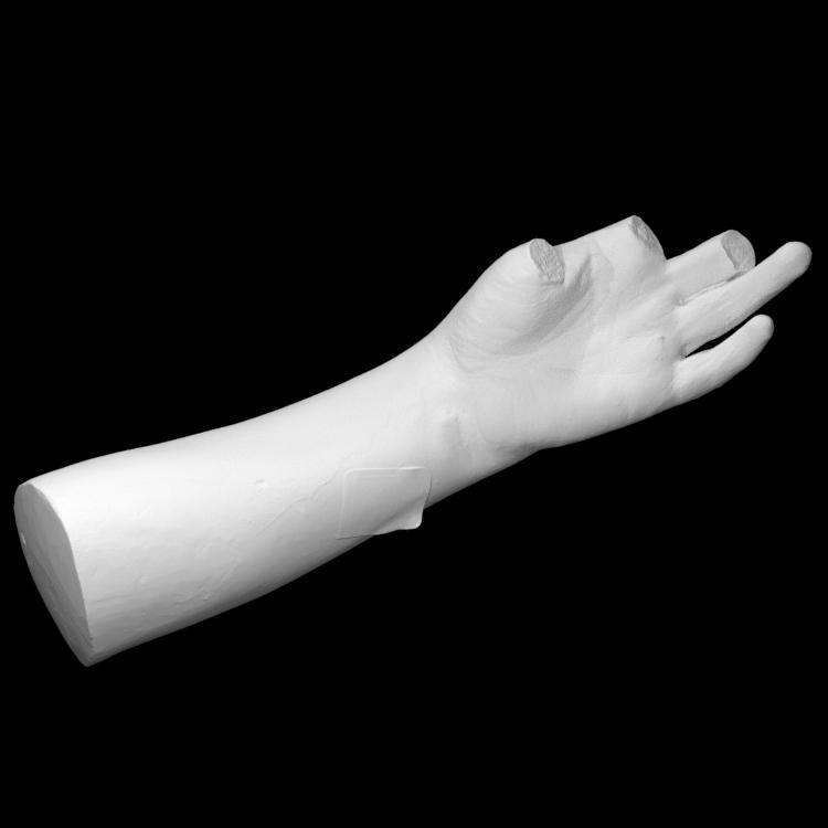Life Cast of Left Forearm and Hand