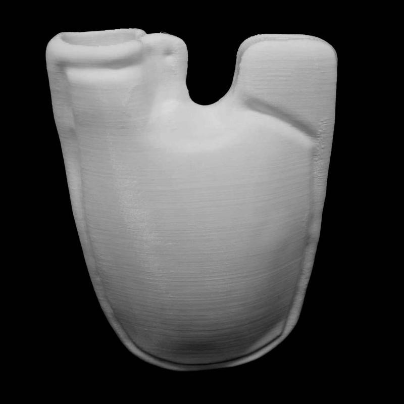 Flask 2 at The British Museum, London