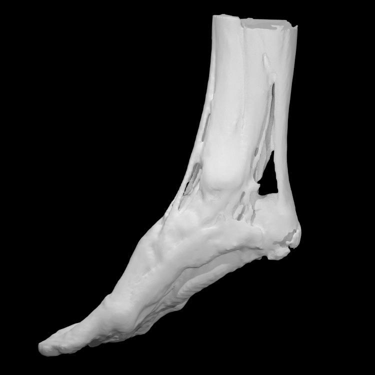 Muscle and tendon structure of a foot