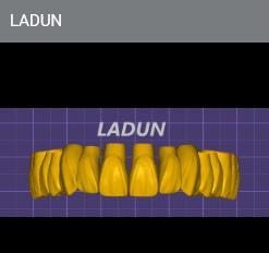 LADUN Exocad Lıbrary