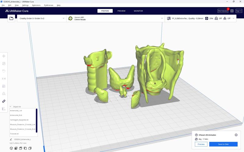 Larynx Model for studies: Speech Therapy and oncology Head and Neck