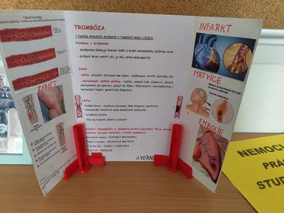 lapbook holder - thrombosis