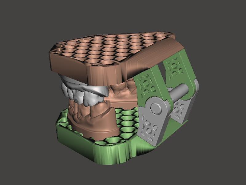 dental articulator with adjustable pin