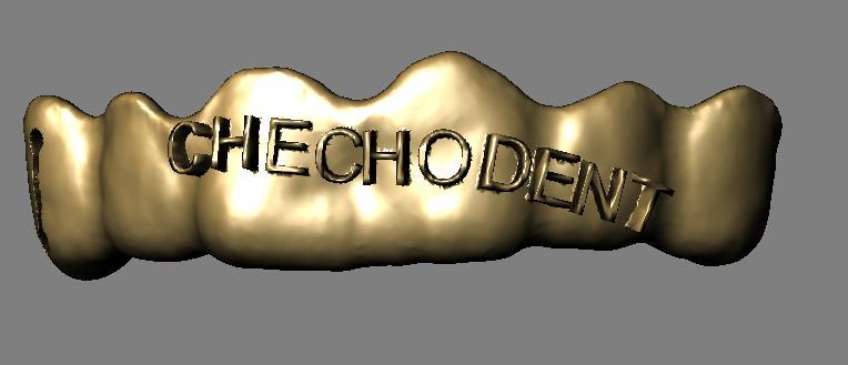 Personalized dental grills