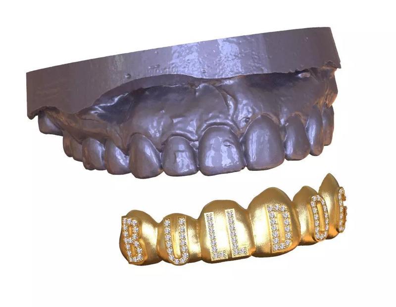grillz gold grill with diamonds