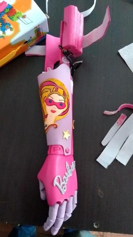 DIY BARBIE MYOELECTRIC ARM