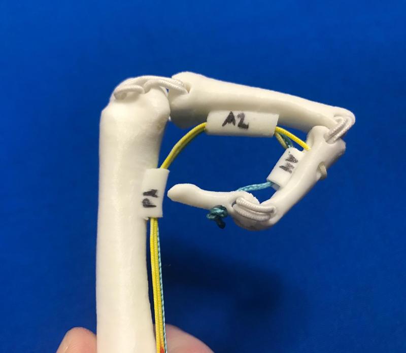 Finger Flexor Tendon Anatomy Model (Left Index)