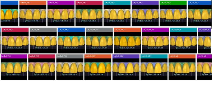 Exocad Lxt Full Library 2025 32 Models