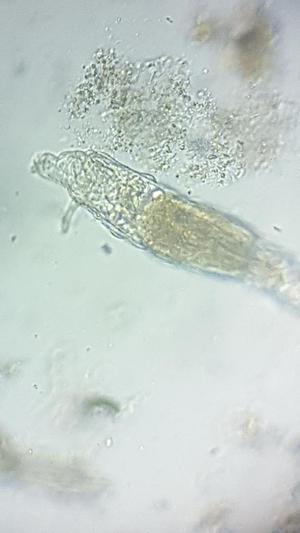 phone microscope adapter