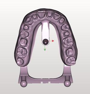 1 in 2 teeth Maxilla