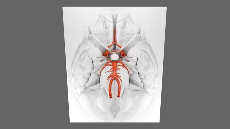 3D CIRCLE OF WILLIS