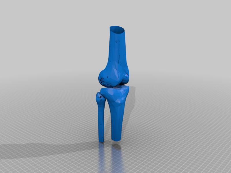 Knee joint