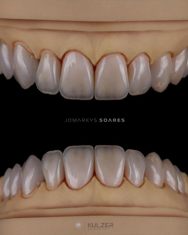Jomarkys Soares Teeth Libraries - Anatomias 2025