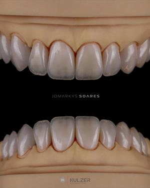 Jomarkys Soares Teeth Libraries - Anatomias 2025