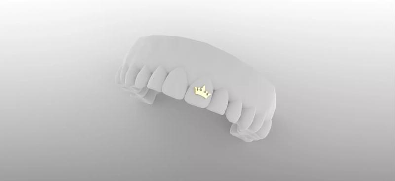 Toothgem Crown Casting Ready