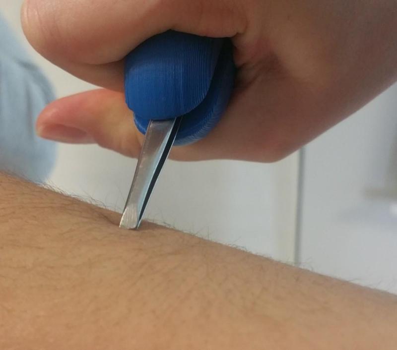 OT student project : adapted tweezers / grossisseur de préhension pour pince à épiler