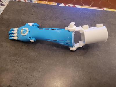 Système de verrouillage pour la prothèse de bras et main Unlimbited Arm