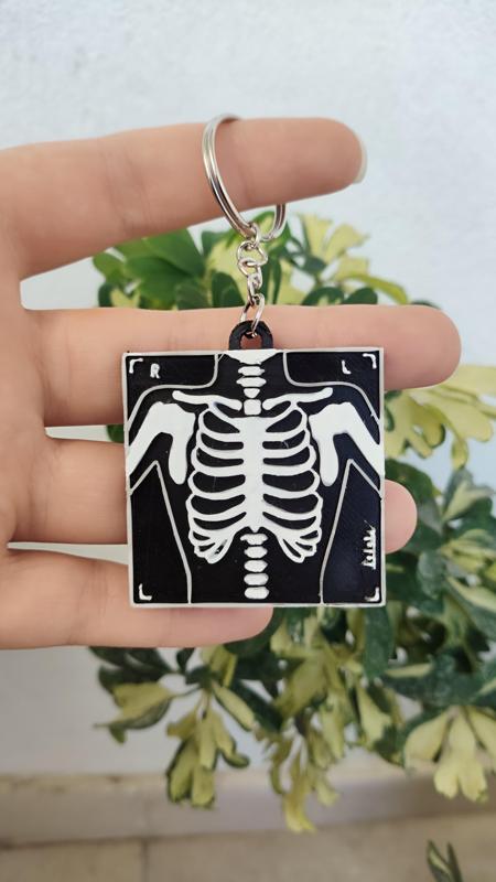 Radiology Key Ring - Chest X-Ray