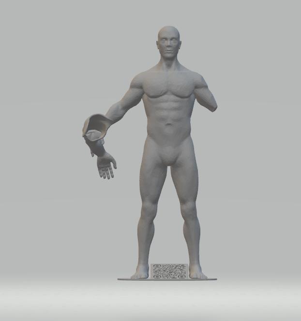 transhumeral prosthesis