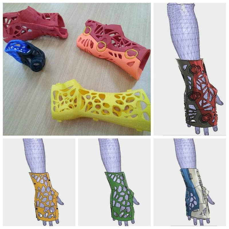 CRE-001 3DCast for Fixation - Huced Despro ITS