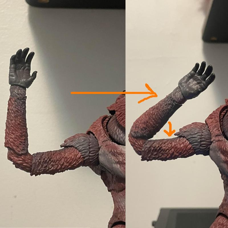 SHMA Skar King elbow peg revision