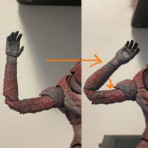 SHMA Skar King elbow peg revision