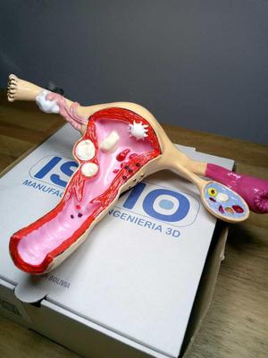 FEMALE REPRODUCTIVE SYSTEM / UTERUS