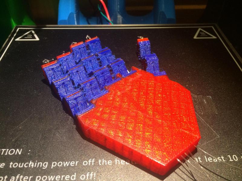 Prosthetic Hand Concept