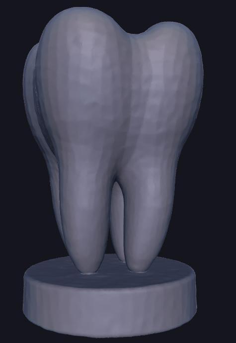 Tooth With Base