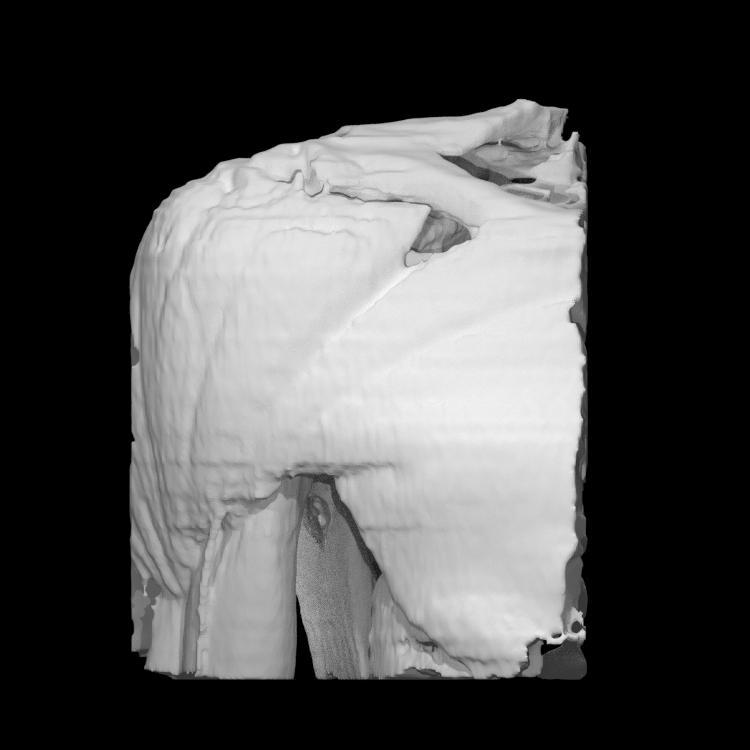 Right shoulder muscles