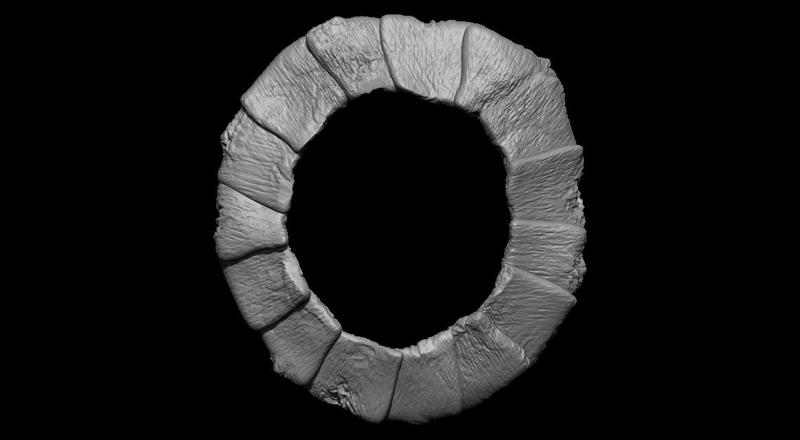 Sclerotic ring