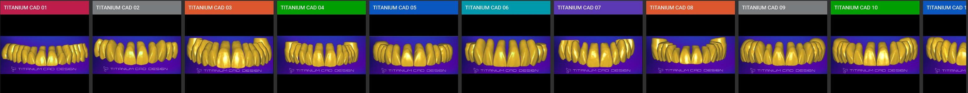 Titanium CAD – 11 Premium Dental Libraries for Exocad + Installation Guide