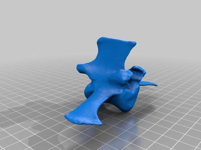 Lumbar Vertebra