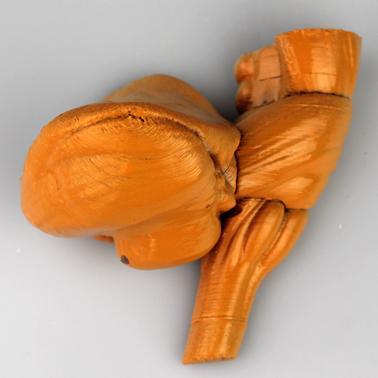 Brain Stem and Posterior Lobe of the Cerebullum