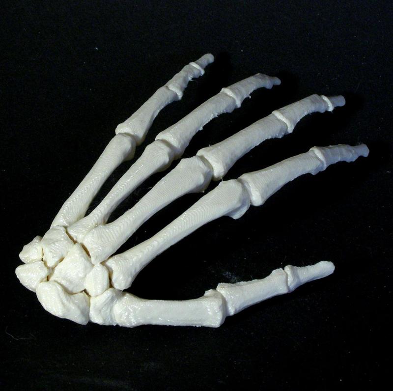 Bone - Hand - Left